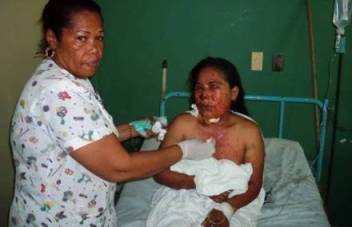 Mujer indigena herida por mina